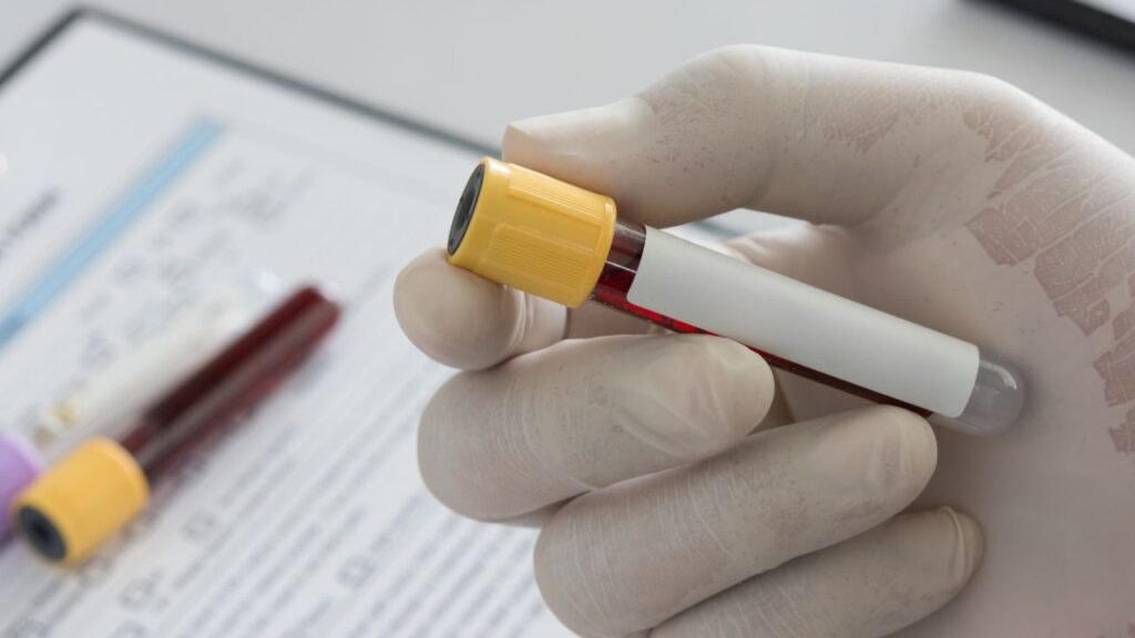 Peptides study
